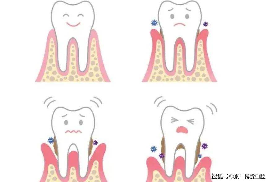 可怕的牙齿苹果版
:刘婧医生：发现牙齿越来越“长”?当心是牙龈萎缩!